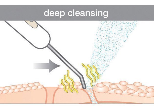 RIO Ultrasonic facial ultrazvuková špachtľa violet