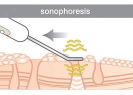 RIO Ultrasonic facial ultrazvuková špachtľa violet