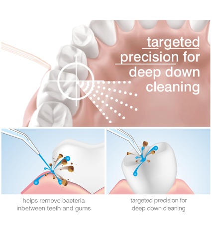 RIO Water Jet Flosser & oral irrigator Ústna sprcha