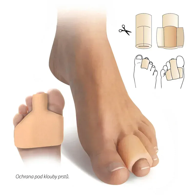 Svorto návlek na ochranu prstov a kĺbov prstov