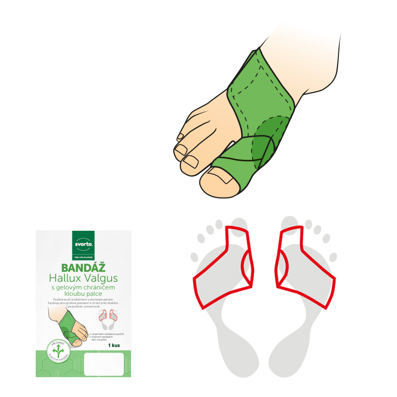 Svorto Bandáž Hallux Valgus s gel. chráničom kĺbu palca